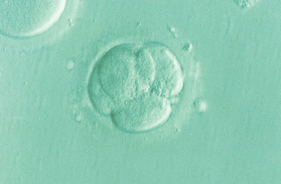 Embryo under microscope